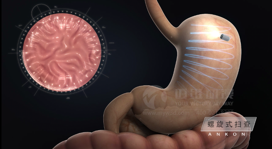 醫學(xué)醫療三維動(dòng)畫(huà) 醫學(xué)醫療三維動(dòng)畫(huà)