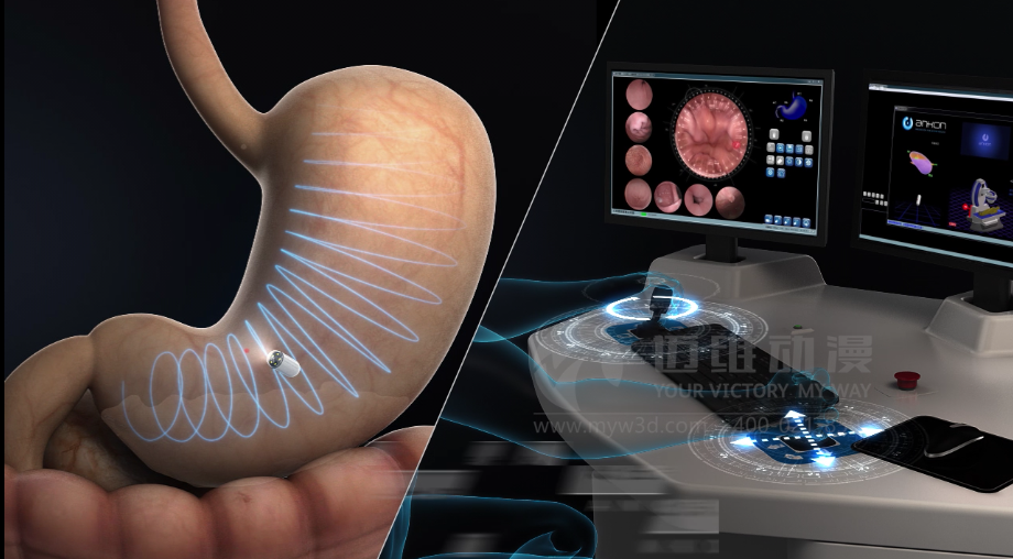 醫學(xué)醫療三維動(dòng)畫(huà) 醫學(xué)醫療三維動(dòng)畫(huà)