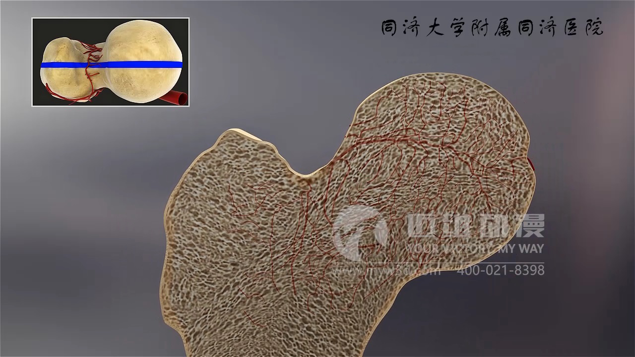 醫學(xué)三維動(dòng)畫(huà) 醫學(xué)三維動(dòng)畫(huà)