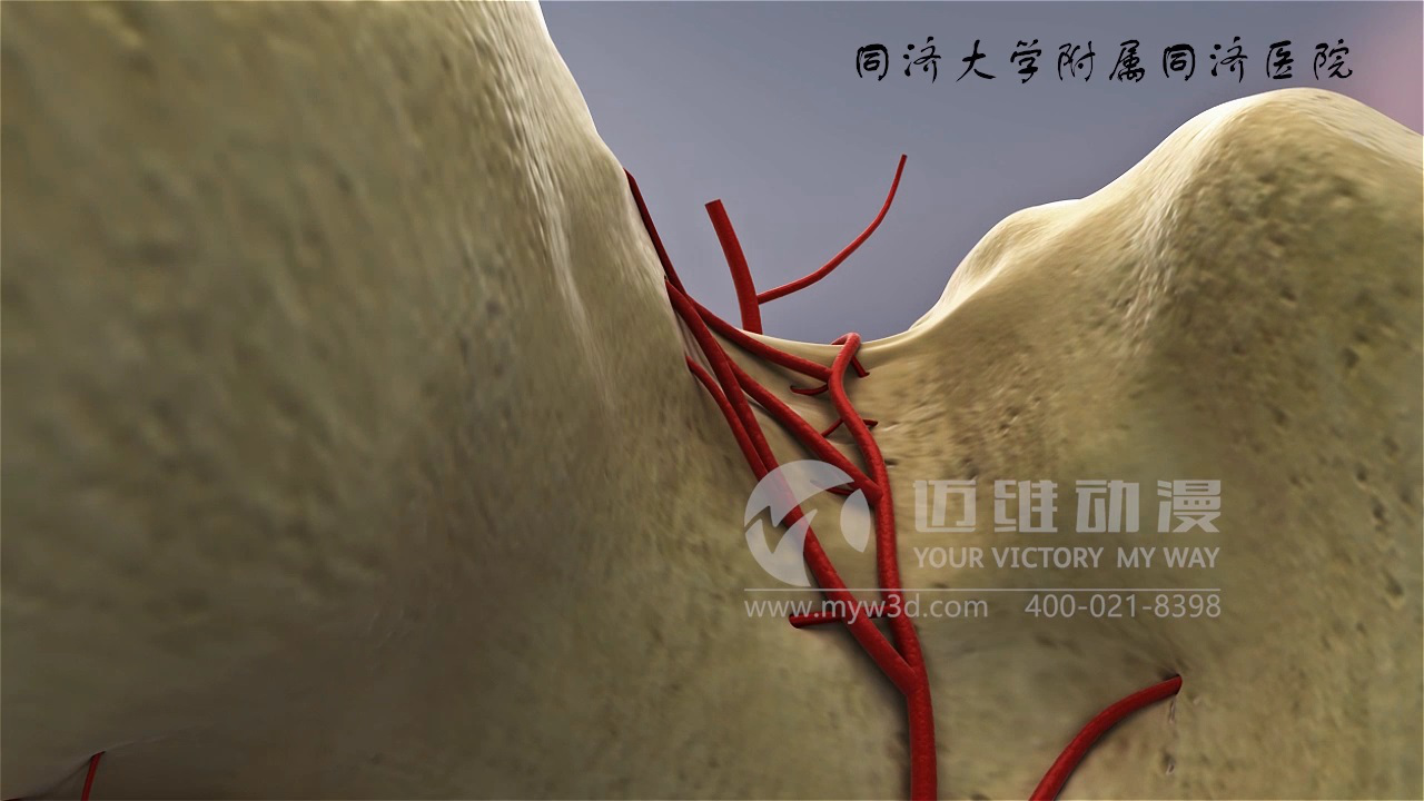 醫學(xué)仿真三維動(dòng)畫(huà)演示 醫學(xué)仿真三維動(dòng)畫(huà)演示