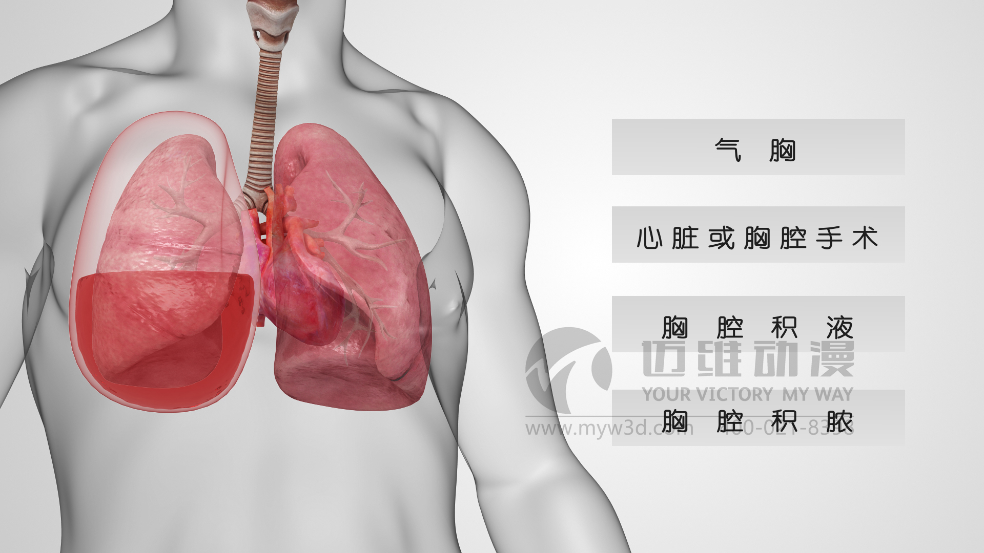 醫療器械動(dòng)畫(huà).jpg 醫療器械動(dòng)畫(huà).jpg