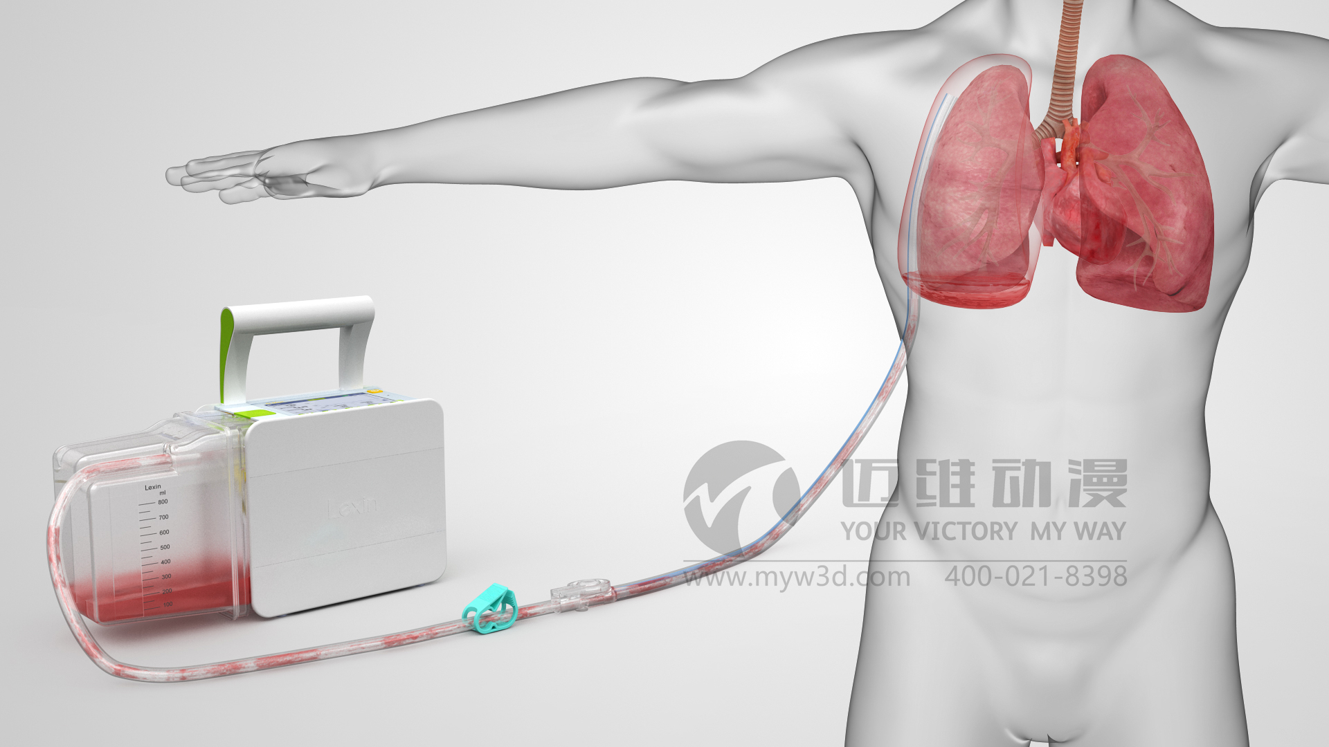 醫療器械動(dòng)畫(huà).jpg 醫療器械動(dòng)畫(huà).jpg