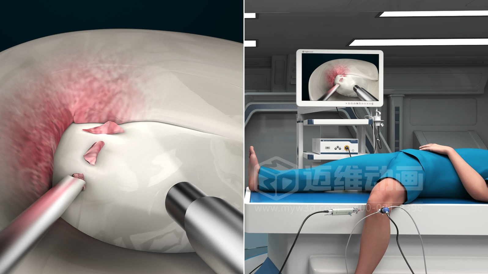 三維動(dòng)畫(huà)制作在展現醫療器械方面能給企業(yè)帶來(lái)諸多優(yōu)勢，這5點(diǎn)不容忽視！(圖3)