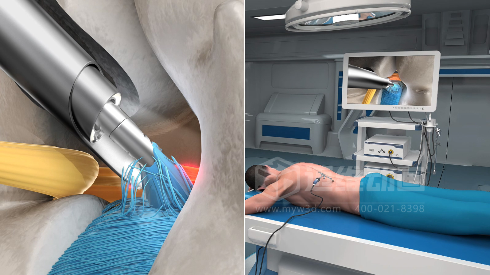 企業(yè)制作工程施工|自動(dòng)化生產(chǎn)線(xiàn)|產(chǎn)品演示|醫學(xué)行業(yè)三維動(dòng)畫(huà)要準備哪些資料，以便有效地提供給三維動(dòng)畫(huà)制作公司呢？(圖7)