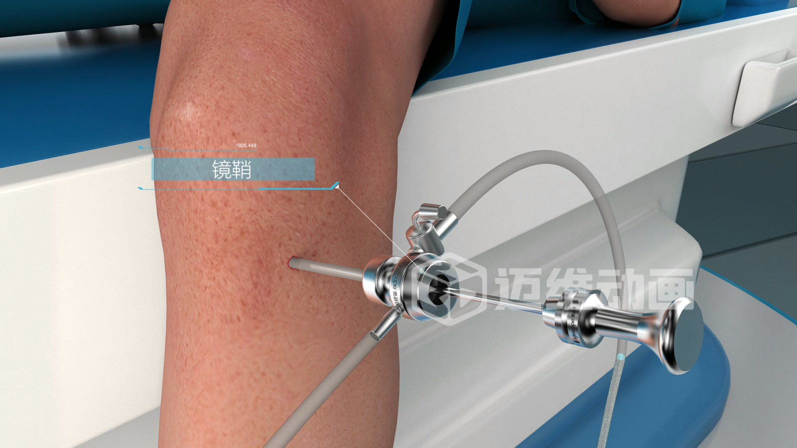 關(guān)節鏡手術(shù)三維動(dòng)畫(huà)