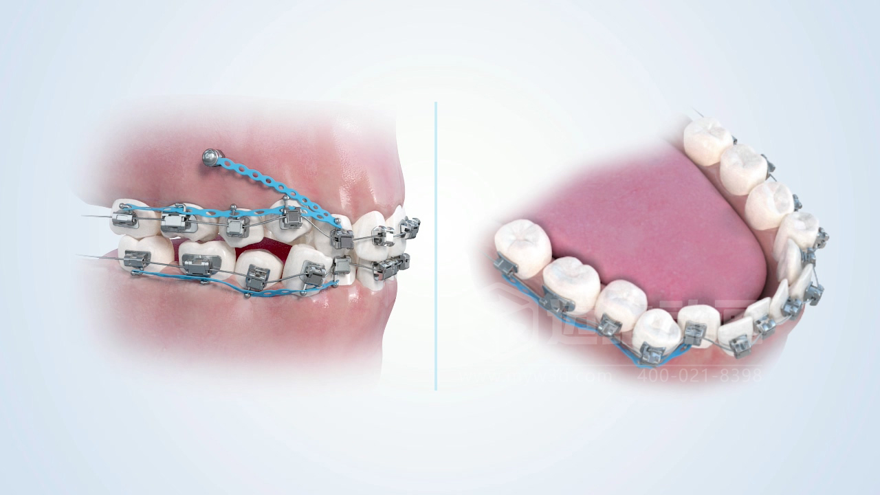 從實(shí)驗室到手術(shù)室：邁維動(dòng)漫用三維動(dòng)畫(huà)，讓精密科技“看得見(jiàn)，懂得到”訂單轉化率提高 50%(圖10)