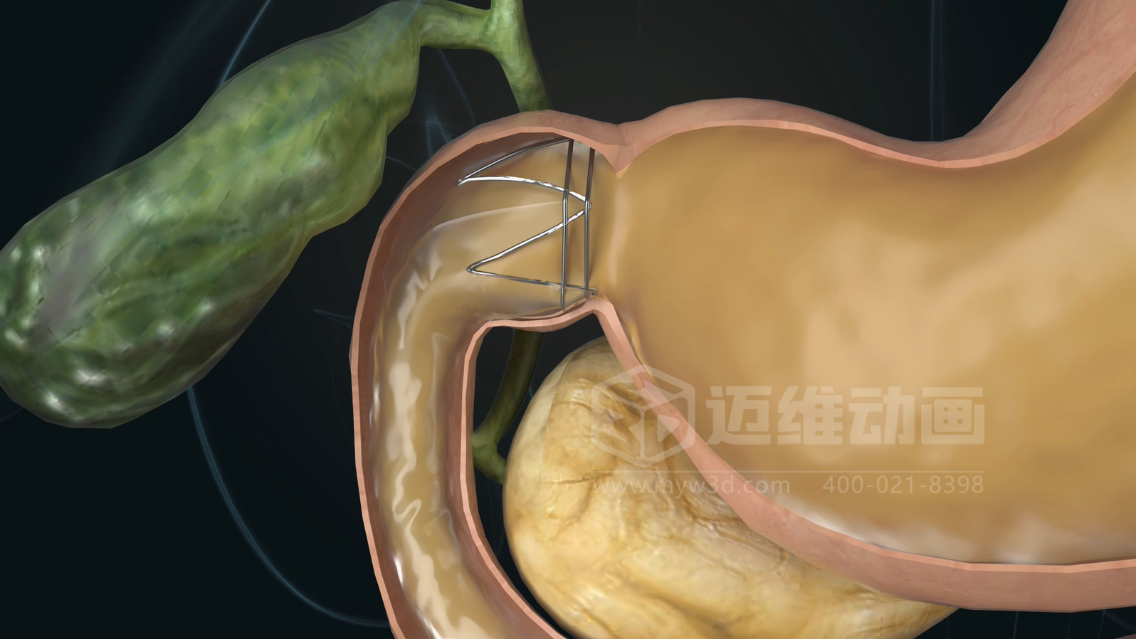 從實(shí)驗室到手術(shù)室：邁維動(dòng)漫用三維動(dòng)畫(huà)，讓精密科技“看得見(jiàn)，懂得到”訂單轉化率提高 50%(圖11)