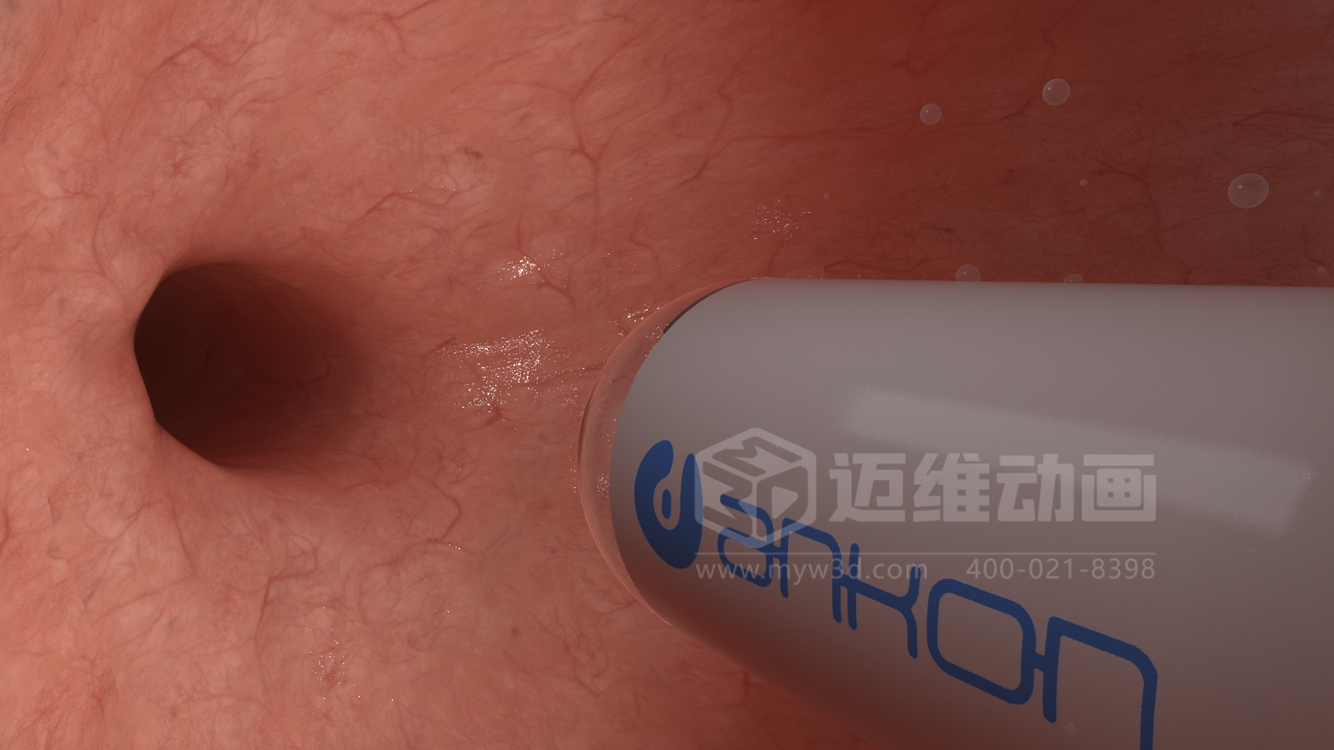 醫學(xué)檢測設備如何突破消化道檢查壁壘？三維動(dòng)畫(huà)還原核心技術(shù)與臨床價(jià)值(圖4)